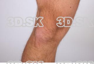 Danas knee 0004